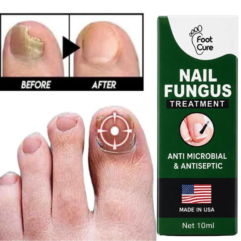 Fast Nail Fungus Treatment Serum | Nail Repair Essence for Fingernails & Toenails | Natural Nail Care Formula - Image 3