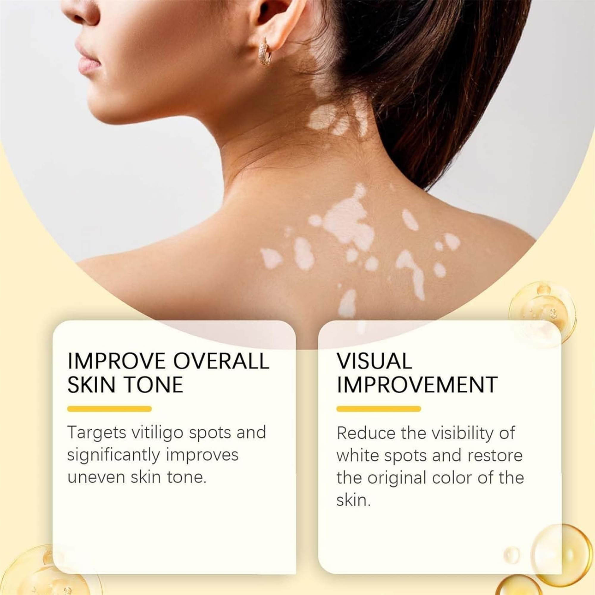 Vitigo Bee Venom Treatment Cream | Natural Skin Repair Hydration Relief Anti-Irritation - Image 3