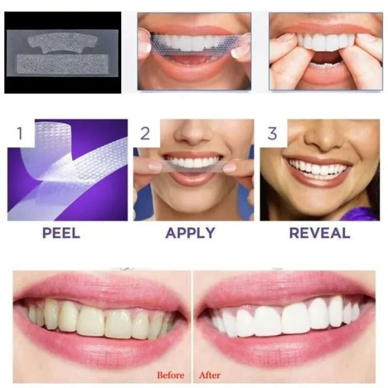 Gegemoon 7D Teeth Whitening Strips | Professional 7-Day Whitening Kit | Enamel Safe Teeth Whitening Strips | Deep Stain Removal | Mint Flavor | 7 Pairs - Image 6