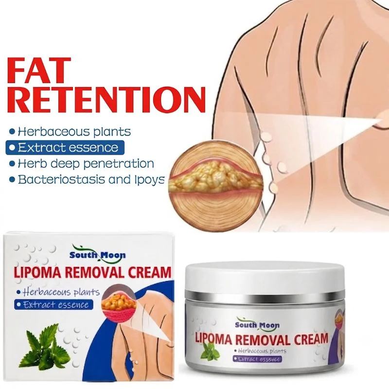 Lipoma Removal Cream | Herbal Skin Care Cream for Smooth & Nourished Skin | Fast-Absorbing Formula | For Neck & Body | 50g - Image 6